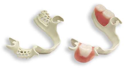 SD360_frame alone and frame with teeth_for PR